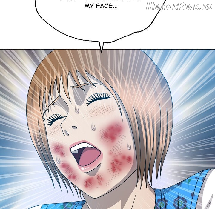 Disfigured - Manhwa Chapter 31 - page 35