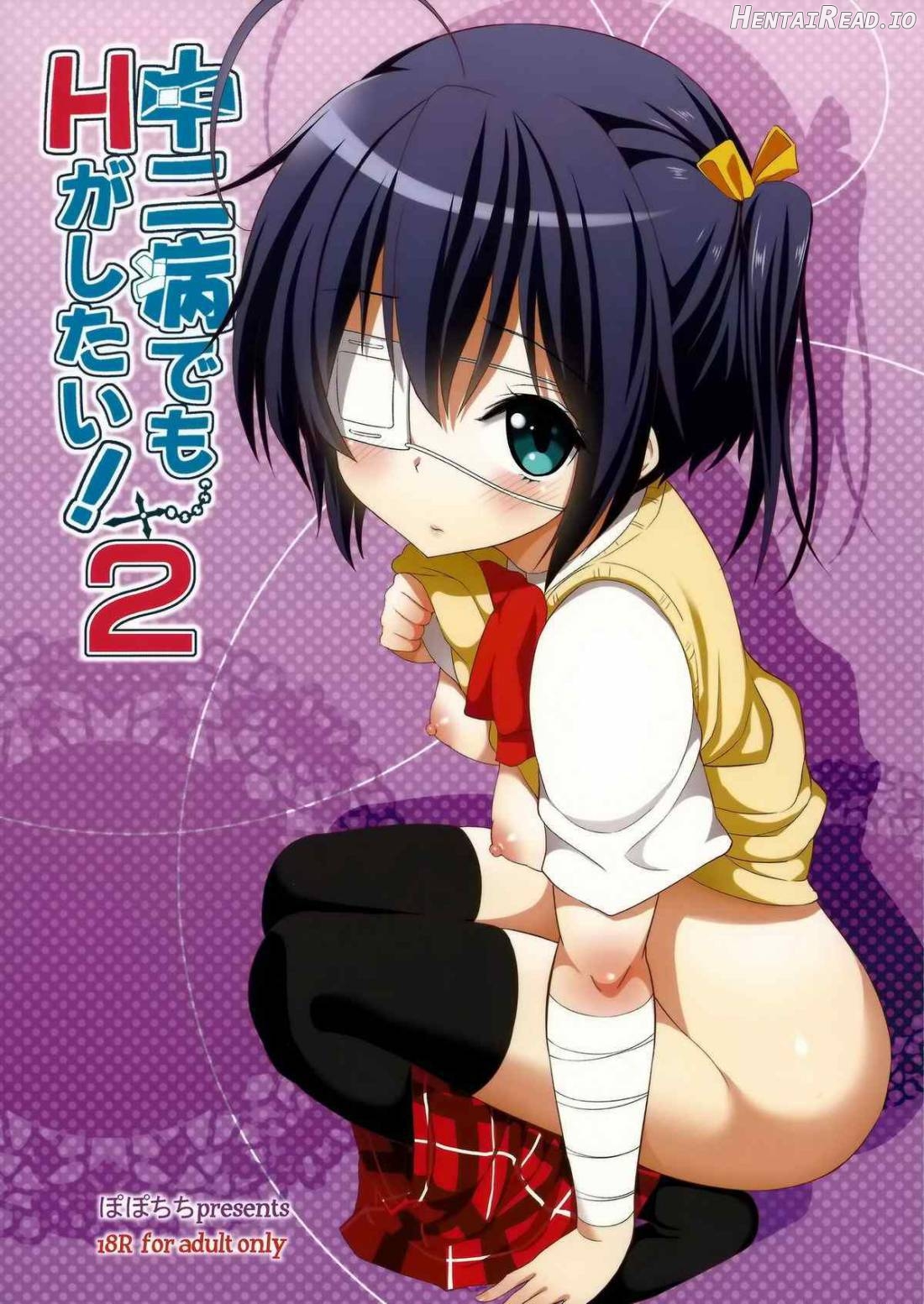 Chuunibyou Demo H ga Shitai! Chapter 2 - page 25