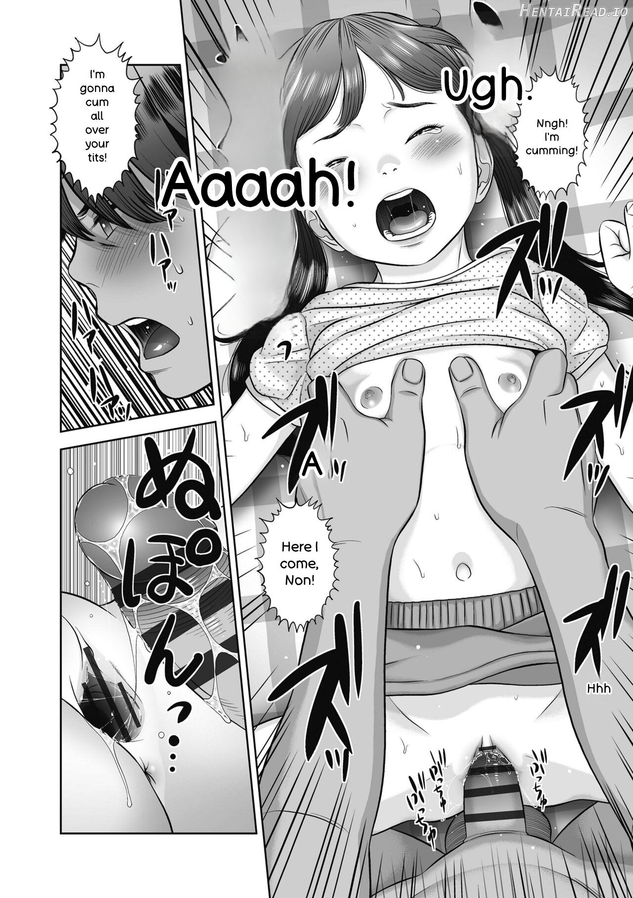 Natsu Loli Ism Chapter 1 - page 156